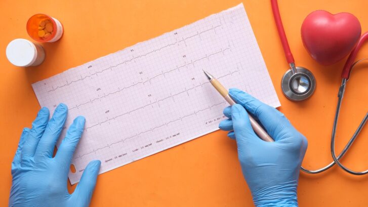 EKG metodą Holtera – na czym polega to badanie?